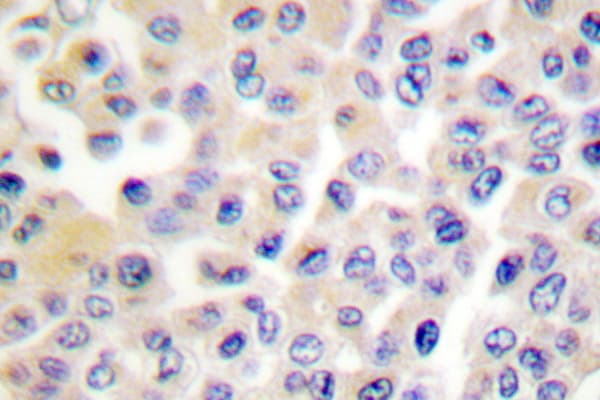 LIMK1 + LIMK2 Antibody (Asp402)