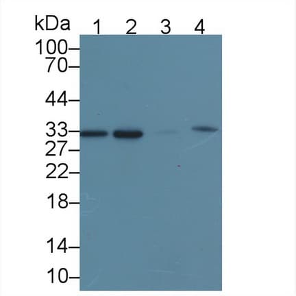 CBR / CBR1 Antibody (aa2-277)