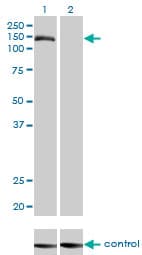 TMEM1 / TRAPPC10 Antibody (clone 5B4)