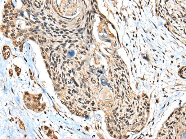CBFB Antibody