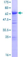 Human TMOD3 / Tropomodulin 3 Protein (Recombinant GST)
