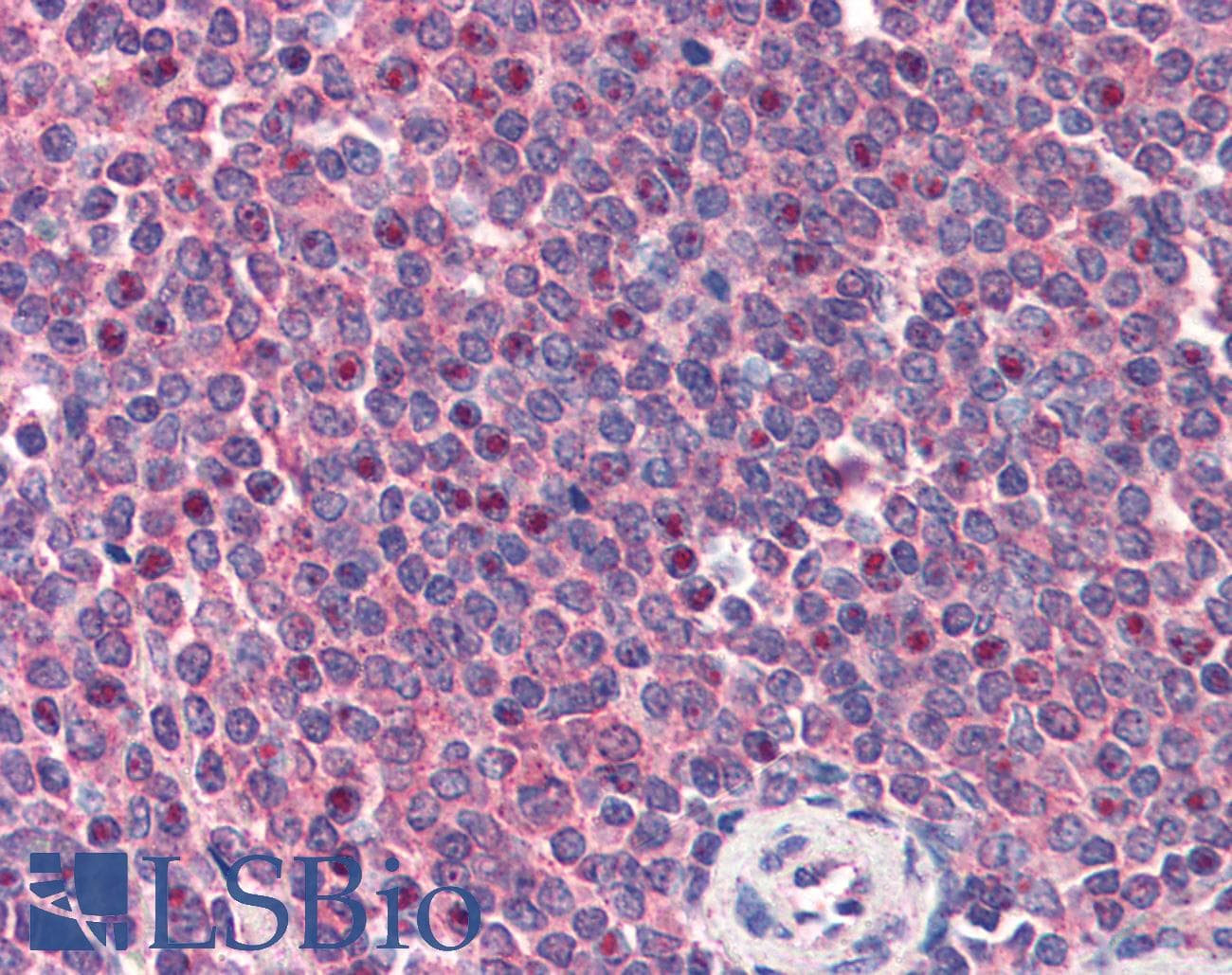 IHC-plus™ CARMA1 / CARD11 Antibody (aa1160-1171)