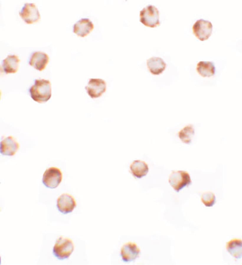 IHC-plus™ SIK2 / SNF1LK2 Antibody