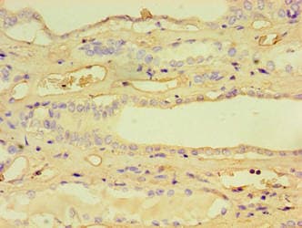 CCBL1 Antibody (aa1-372)