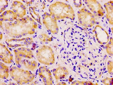 Polyclonal Rabbit anti-Human DLD / Diaphorase / E3 Antibody (IHC, WB)