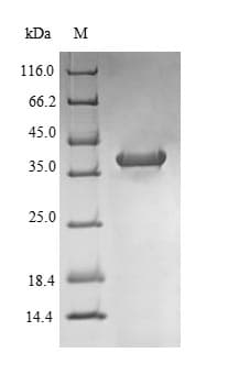 Human NR1I2 / PXR Protein (Recombinant 10His-SUMO, N-terminus + Myc, C-terminus)