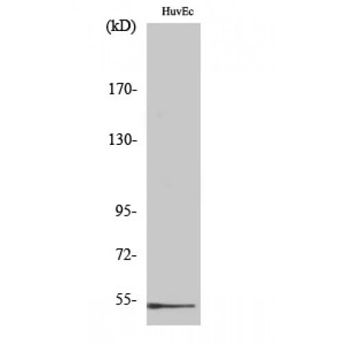 GC / Vitamin D-Binding Protein Antibody (90-170 aa, Internal)
