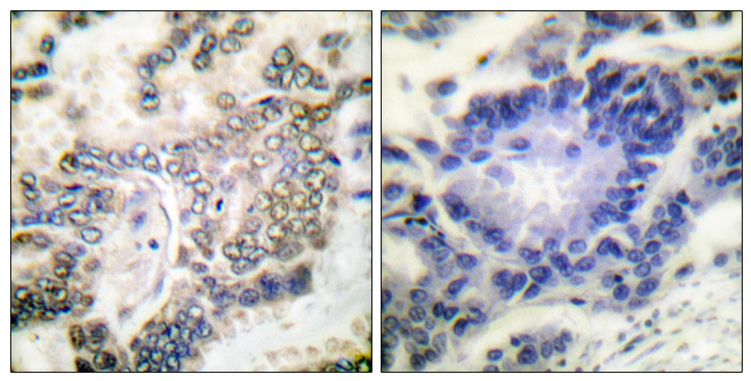 C/EBP Alpha / CEBPA Antibody (p21)