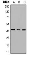 RSPH14 / RTDR1 Antibody (C-Terminus)