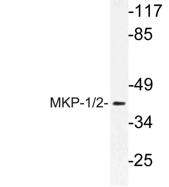 Polyclonal Rabbit anti-Human DUSP1 / MKP1 Antibody (Gln290, IHC, WB)