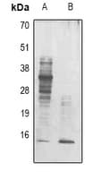 Monoclonal Mouse Acetyl-Lysine Antibody (IHC, WB)