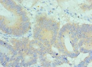 Polyclonal Rabbit anti-Human SNK / PLK2 Antibody (aa336-685, IHC)