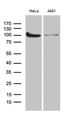 KPNB1 / Importin Beta Antibody (aa1-200, clone OTI10D3)