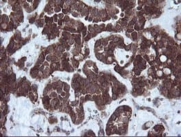 NDUFB9 Antibody (clone OTI3A1)