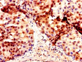 DMRT1 Antibody