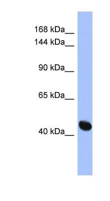 Polyclonal Rabbit anti-Human RASGRF1 / CDC25 Antibody (aa107-156, WB)
