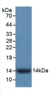 S100A9 / MRP14 Antibody (aa1-114)