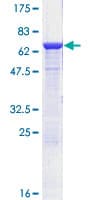 Human ADH1C Protein (Recombinant GST)