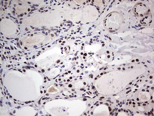 SAE1 Antibody (clone OTI3C3)