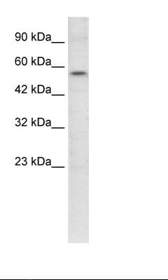 ETS1 / ETS-1 Antibody (aa52-101)