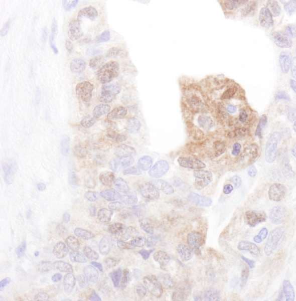 Polyclonal Rabbit anti-Human CAMK4 / CaMK IV Antibody (aa425-C-term, IHC, WB)