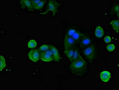 Polyclonal Rabbit anti-Human FZD1 / Frizzled 1 Antibody (IHC, IF)