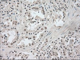 NTRK3 / TRKC Antibody (clone OTI2B8)
