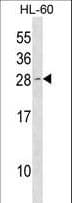 CDKN1B / p27 Kip1 Antibody (aa1-30)