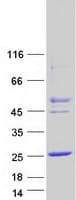 Human CTAG2 Protein (Recombinant Myc-DDK (Flag))
