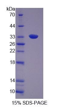 Rat GRB14 Protein (Recombinant His, N-Terminal)