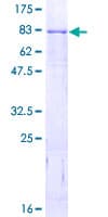 Human RORA / ROR Alpha Protein (Recombinant GST)
