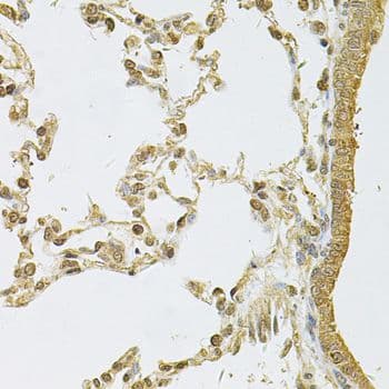 PSMA5 Antibody