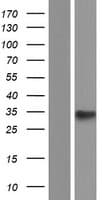 PRR7 Protein (Over-Expression Lysate Myc-DDK (Flag))
