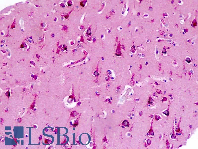IHC-plus™ CNR2 / CB2 Antibody (aa191-240)