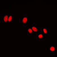 CBX5 / HP1 Alpha Antibody (Internal)