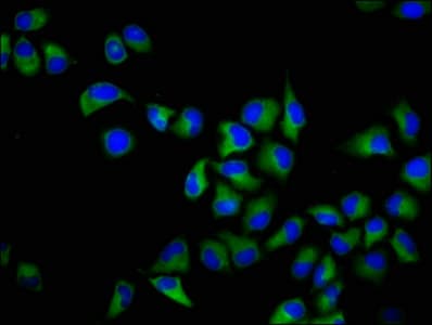 Polyclonal Rabbit anti-Human JAM3 Antibody (IHC, WB)