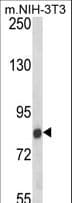 TARSL2 Antibody (aa380-408)