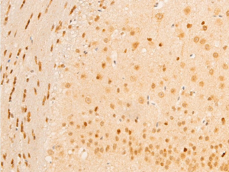 MAP3K7 / TAK1 Antibody (phospho-Thr187)