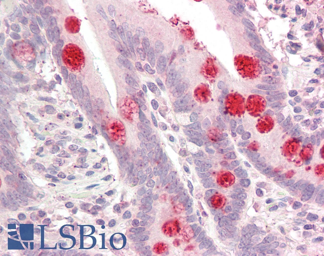 IHC-plus™ Polyclonal Rabbit anti-Human CNTD2 Antibody (aa51-100, IHC)