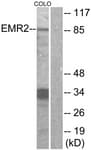 Polyclonal Rabbit anti-Human ADGRE2 / EMR2 Antibody (aa765-814, IF, WB)