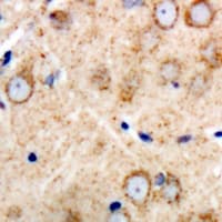 Polyclonal Rabbit anti-Human PMP22 Antibody (C-Terminus, IHC, WB)