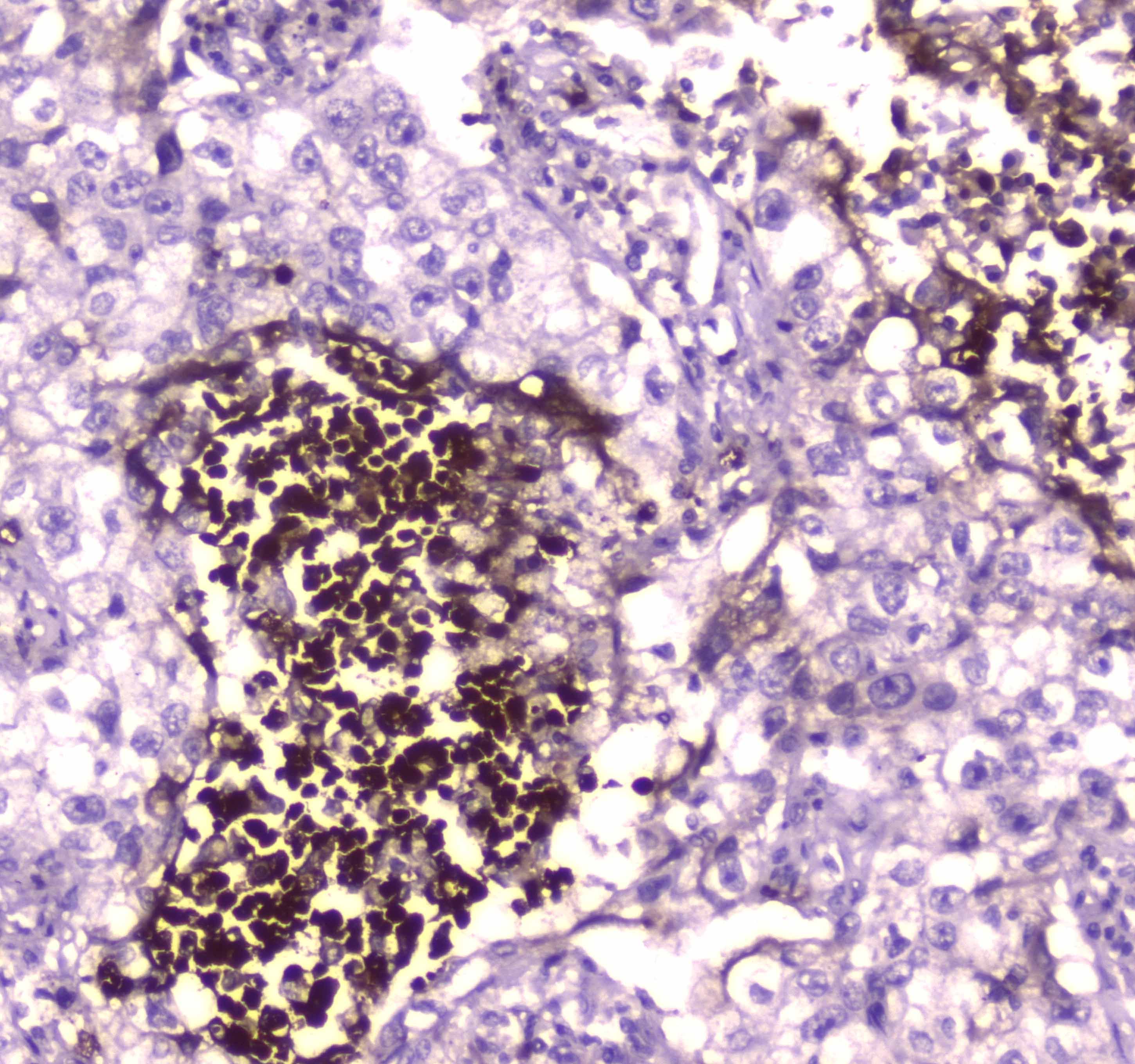 Polyclonal Rabbit anti-Human LF / LTF / Lactoferrin Antibody (IHC, WB)