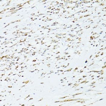 Polyclonal Rabbit anti-Human TRIM15 Antibody (IHC, WB)