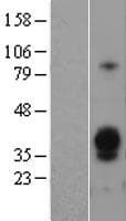 ASGR1 / ASGPR Protein (Over-Expression Lysate Myc-DDK (Flag))
