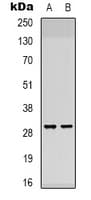 ATP5F1 Antibody (Internal)