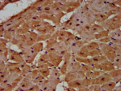 Polyclonal Rabbit anti-Human MCC Antibody (IHC, IF)