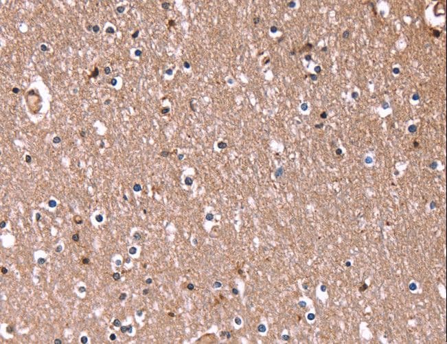 RDX / Radixin Antibody