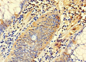 Polyclonal Rabbit anti-Human SYTL3 Antibody