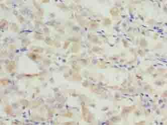 Polyclonal Rabbit anti-Human GCSAML / C1orf150 Antibody (IHC)