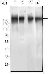 Monoclonal Mouse anti-Human EGFR Antibody (clone 5G9B5, aa693-893, IHC, WB)